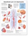 Understanding Hypertension Anatomical Chart in Spanish (Entendiendo Que Es la Hypertension)