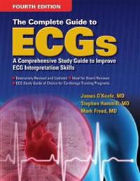 Complete Guide to ECG's