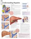 Understanding Hepatitis Laminated Poster