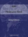 MRI Atlas of the Head and Neck