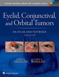 Eyelid, Conjunctival, and Orbital Tumors