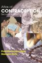 Atlas of Contraception
