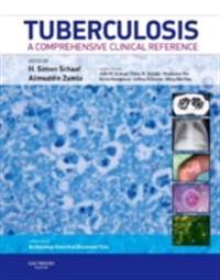 Tuberculosis E-Book