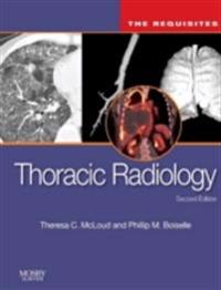Thoracic Radiology: The Requisites E-Book