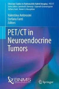 Pet/Ct in Neuroendocrine Tumors