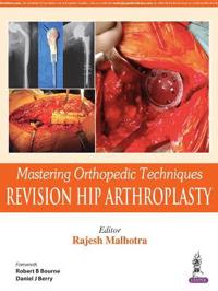 Mastering Orthopedic Techniques- Revision Hip Arthroplasty