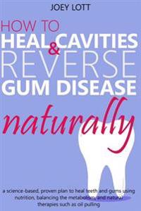 How to Heal Cavities and Reverse Gum Disease Naturally: A Science-Based, Proven Plan to Heal Teeth and Gums Using Nutrition, Balancing the Metabolism,