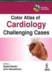 Color Atlas of Cardiology