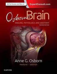 Osborn's Brain + Expert Consult