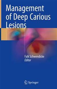 Management of Deep Carious Lesions
