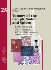 Tumors of the Lymph Node and Spleen