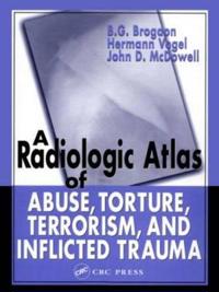 A Radiologic Atlas of Abuse, Torture, Terrorism and Inflicted Trauma