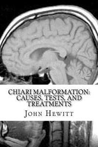 Chiari Malformation: Causes, Tests, and Treatments