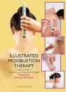 The Illustrated Moxibustion Therapy