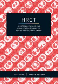 HRCT ? Mustererkennung und Differentialdiagnostik von Lungenerkrankungen