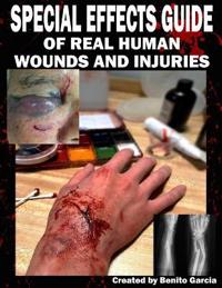 Special Effects Guide of Real Human Wounds and Injuries: Special Effects Guide of Real Human Wounds and Injuries
