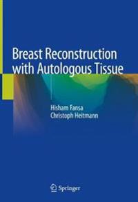 Breast Reconstruction with Autologous Tissue