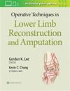 Operative Techniques in Lower Limb  Reconstruction and Amputation