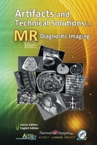 Artifacts and Technical Solutions in MR Diagnostic Imaging