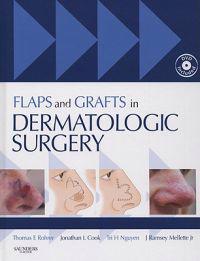 Flaps And Grafts in Dermatologic Surgery