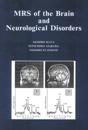 MRS of the Brain and Neurological Disorders