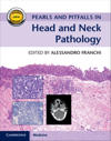 Pearls and Pitfalls in Head and Neck Pathology with Online Resource