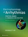Electrophysiology of Arrhythmias