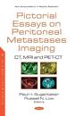 Pictorial Essays on Peritoneal Metastases Imaging