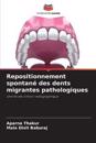 Repositionnement spontané des dents migrantes pathologiques
