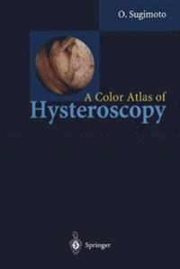 A Color Atlas of Hysteroscopy