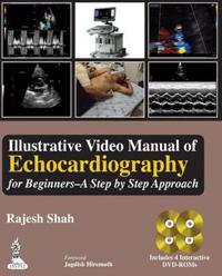 Illustrative Video Manual of Echocardiography for Beginners