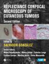Reflectance Confocal Microscopy of Cutaneous Tumors