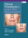 Clinical Procedures in Laser Skin Rejuvenation