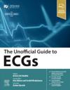 The Unofficial Guide to ECGs