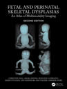 Fetal and Perinatal Skeletal Dysplasias