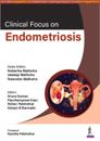 Clinical Focus on Endometriosis
