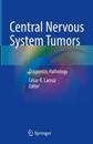 Central Nervous System Tumors