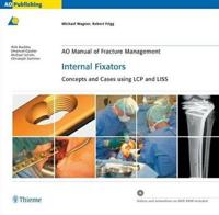 Ao Manual of Fracture Management