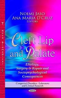 Cleft LipPalate