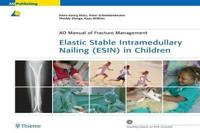 Elastic Stable Intramedullary Nailing Esin in Children