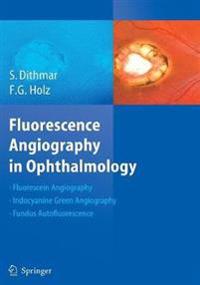 Fluorescence Angiography in Ophthalmology